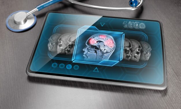 How Functional MRI is Changing Chronic Pain Diagnosis and Treatment